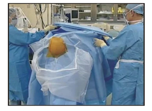 craniotomy-drape-500x500