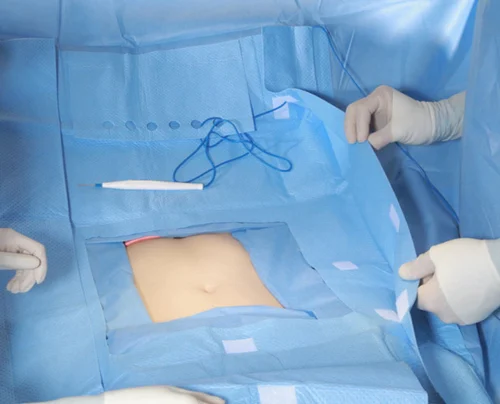 disposable-surgical-drapes-500x500